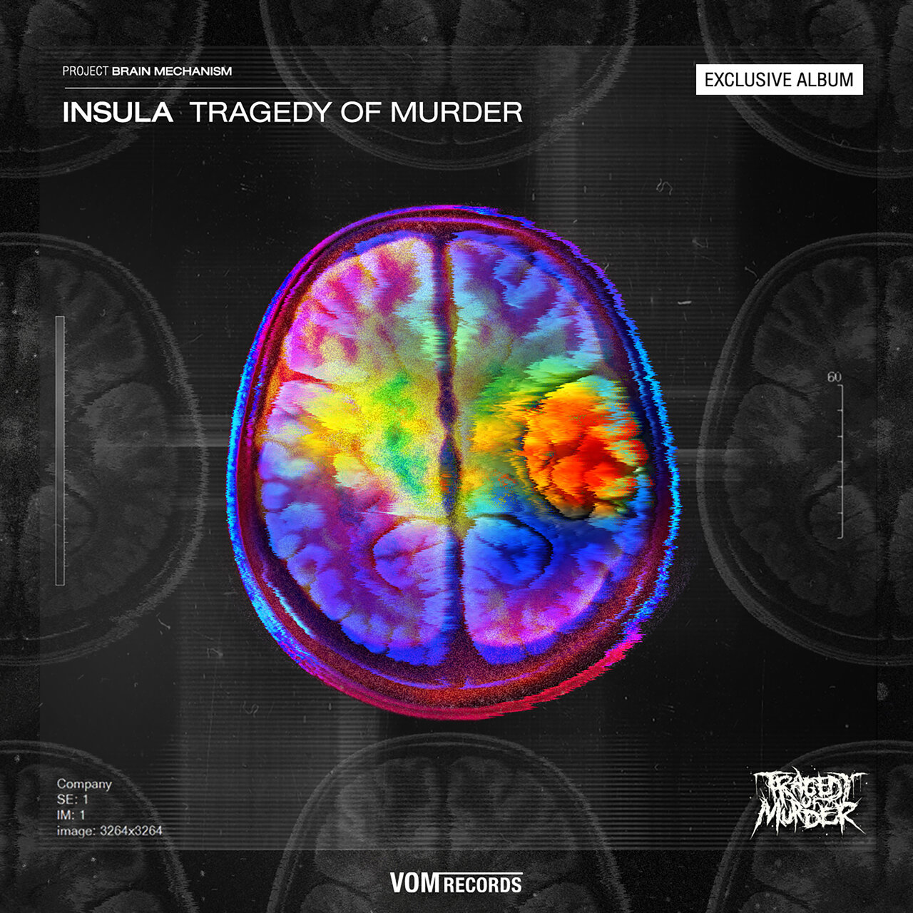 TOM insula from project brain mechanism